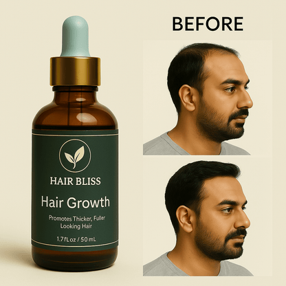 Hair Growth Serum Organic Hair Serum Hair Bliss 